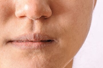راه نجات از پیری زودرس چیست؟