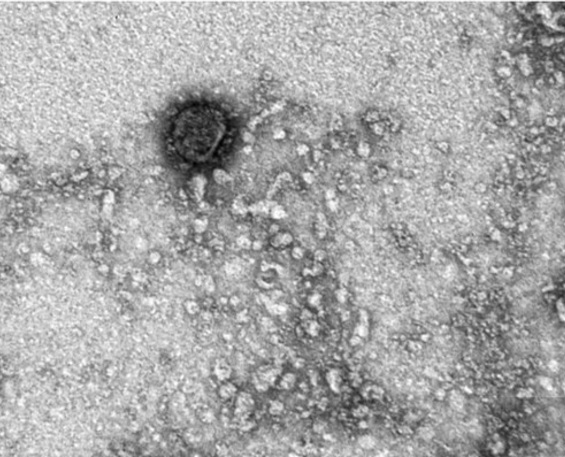 کشف مهم یک اسید چرب در ساختار ویروس کرونا