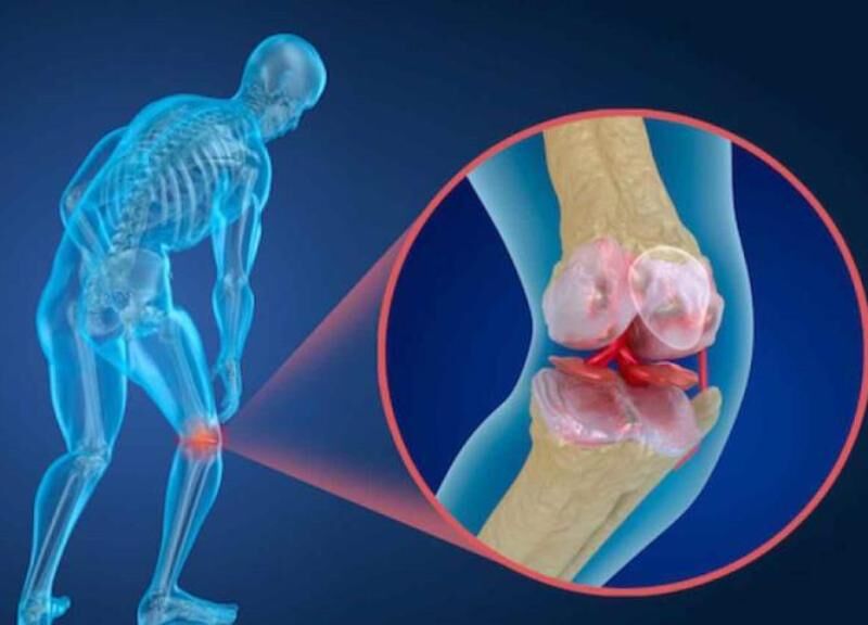 دلایل به وجود آمدن «پوکی استخوان» از منظر طب سنتی