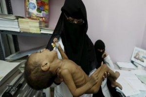 گرسنگی و مرگ در کمین هزاران یمنی است
